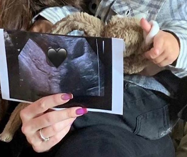 Babynieuws voor Temptation Island-koppel