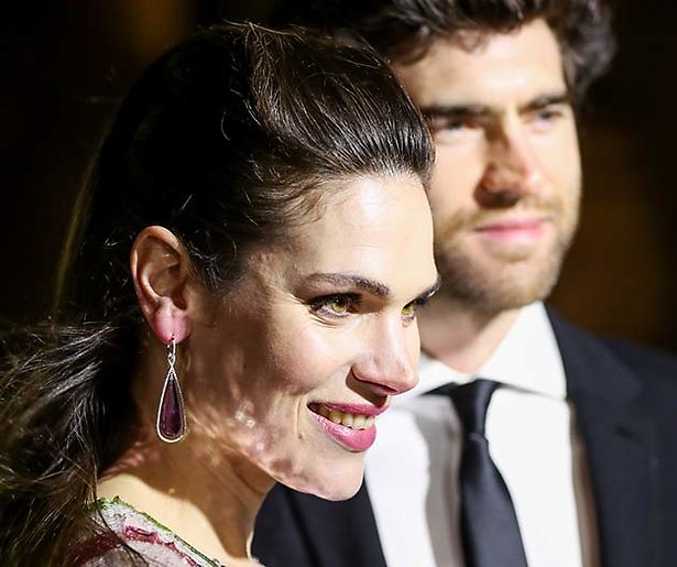 Hoera! Anna Drijver en Benja Bruijning voor tweede keer ouders