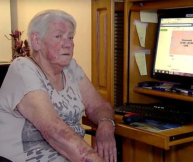 Videosnack: Antje treurt nog steeds om Hyves in Man Bijt Hond