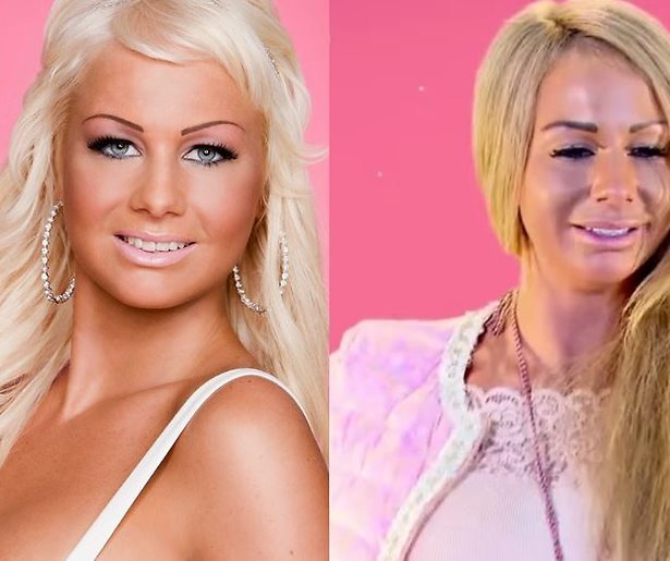 Barbie laat cosmetische ingreep live filmen