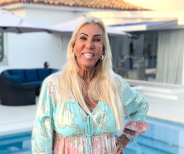 Dit gerucht gaat al rond over B&B Vol Liefde 2026