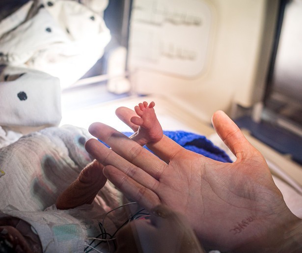 Een stoma voor kleine Ace in Handen aan de Couveuse