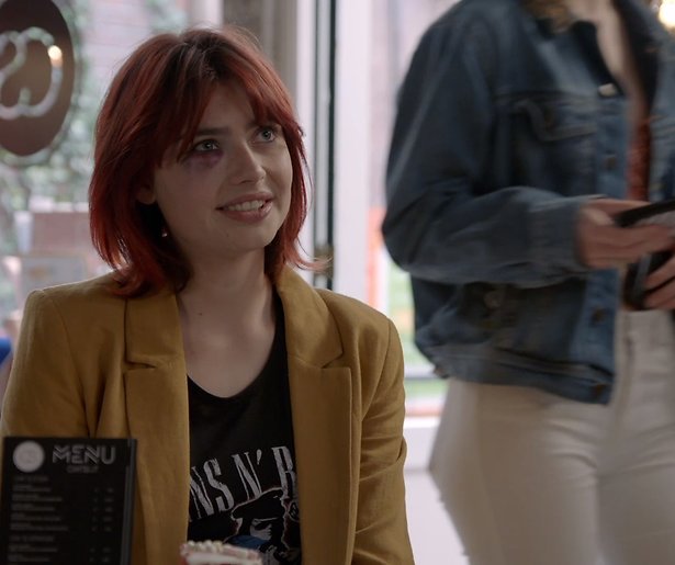 Om deze reden heeft Merel een blauw oog in GTST