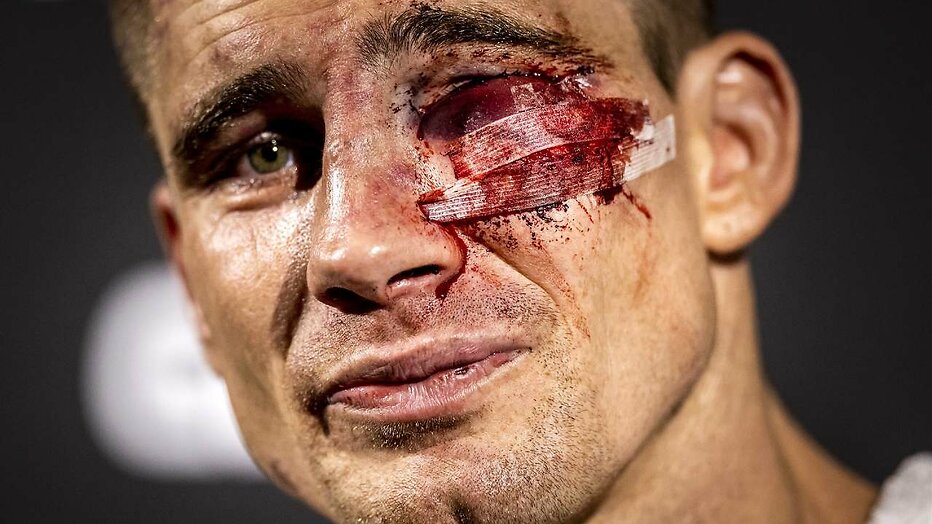 Rico Verhoeven Rico Verhoeven