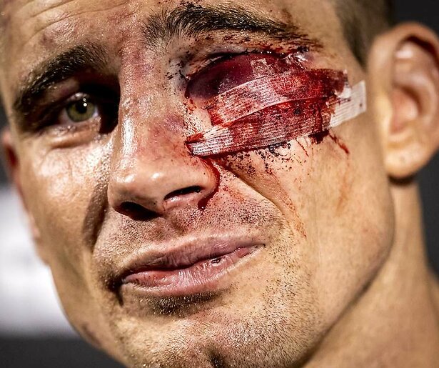 Glory-gevechten voortaan exclusief op Videoland