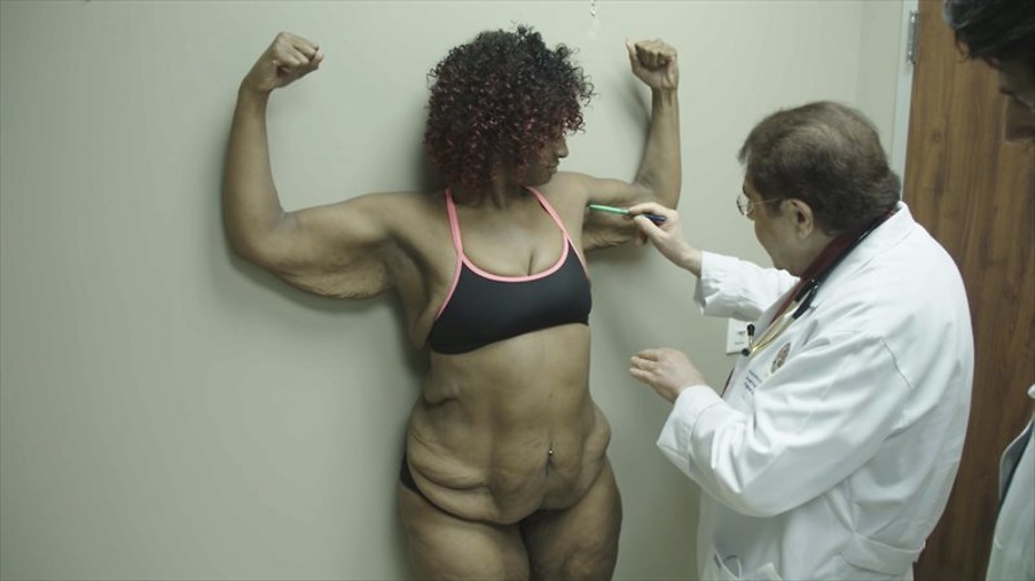 Weg met overtollig vel in Skin Tight 