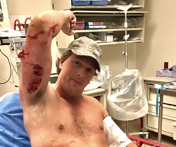 Freek Vonk kan alweer lopen