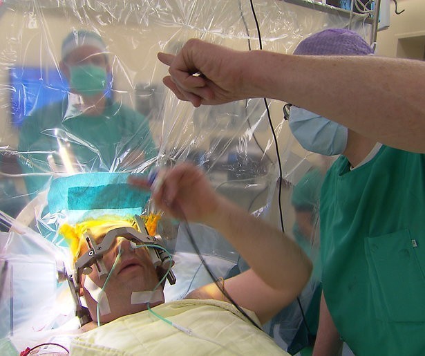 Kijktip: Wakker blijven tijdens hersenoperatie in Zij Houden Nederland in Leven